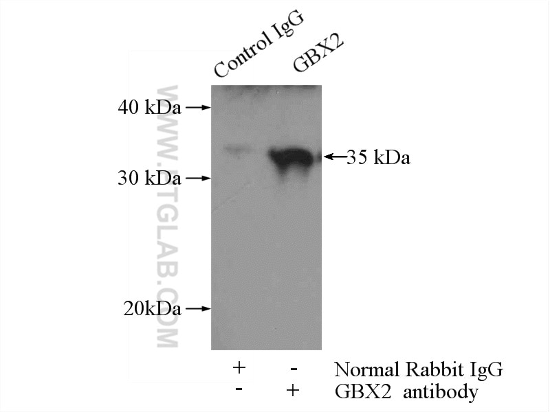 Immunoprecipitation (IP) experiment of HeLa cells using GBX2 Polyclonal antibody (21639-1-AP)