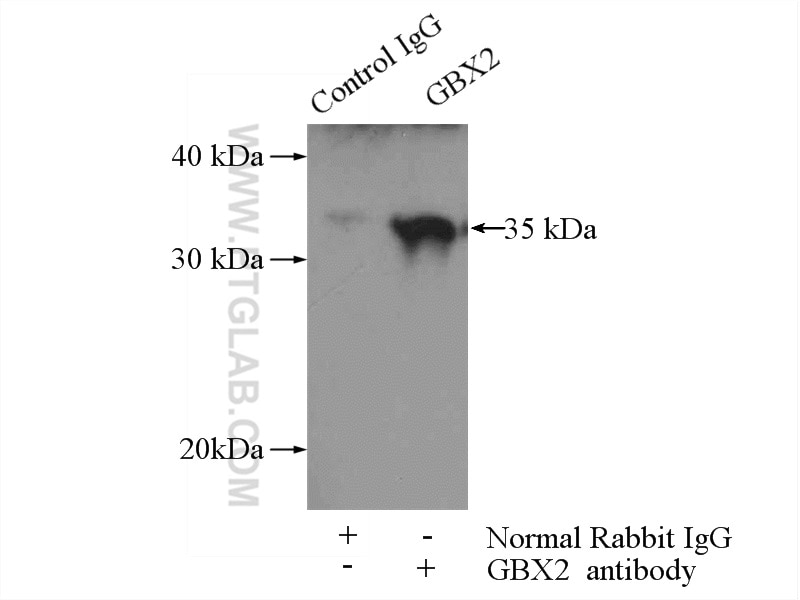 IP experiment of HeLa using 21639-1-AP