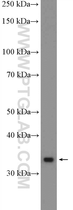 Western Blot (WB) analysis of mouse stomach tissue using GBX2 Polyclonal antibody (21639-1-AP)