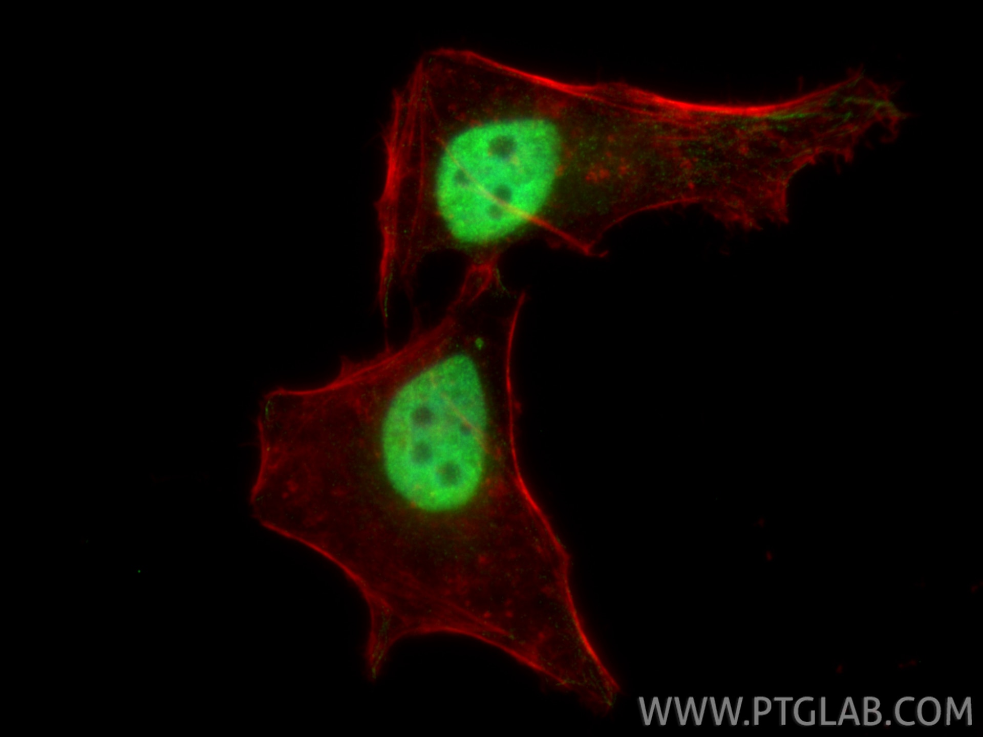 IF Staining of HeLa using 61029-1-Ig Immunofluorescence (IF) / fluorescent staining of HeLa cells using GBX2 Monoclonal antibody (61029-1-Ig)