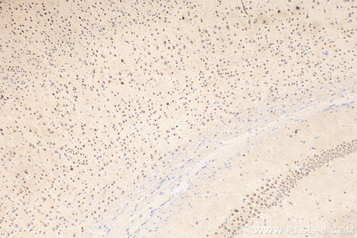 IHC staining of mouse brain using 61029-1-Ig Immunohistochemistry (IHC) staining of mouse brain tissue using GBX2 Monoclonal antibody (61029-1-Ig)
