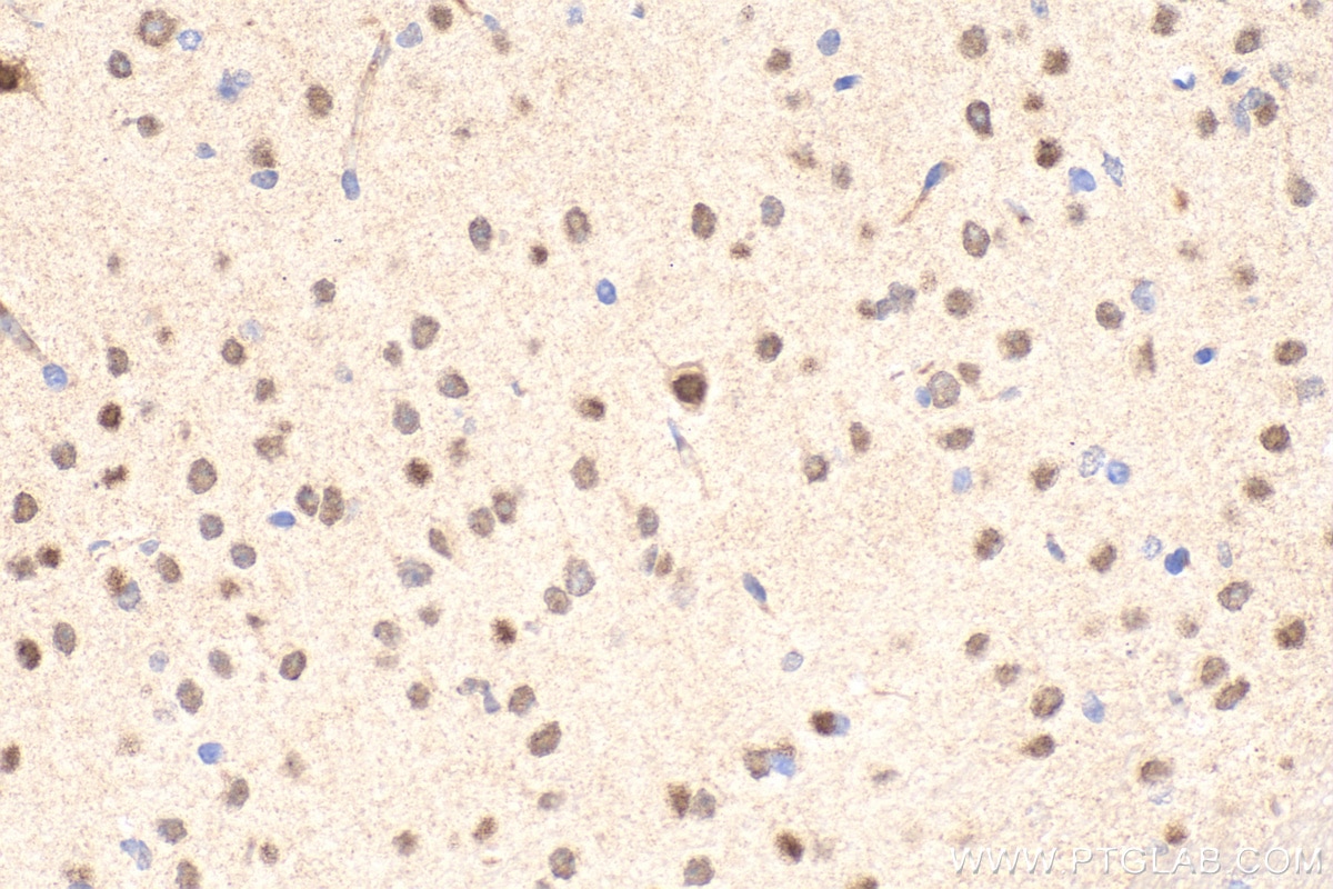 IHC staining of mouse brain using 61029-1-Ig Immunohistochemistry (IHC) staining of mouse brain tissue using GBX2 Monoclonal antibody (61029-1-Ig)