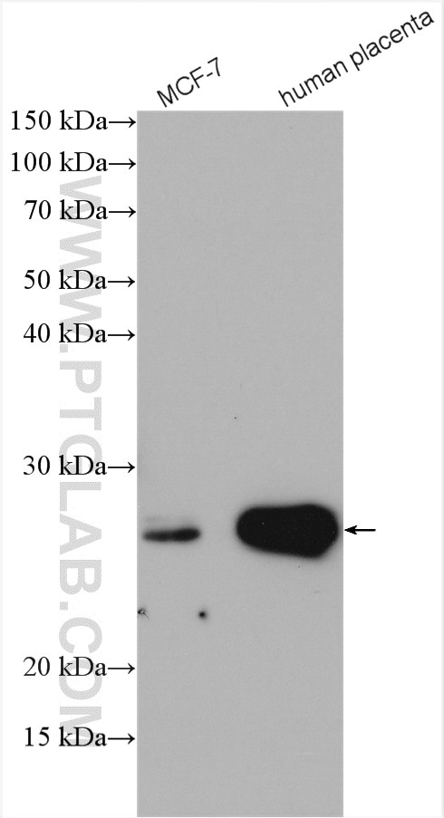 Western Blot (WB) analysis of various lysates using Grancalcin Polyclonal antibody (15787-1-AP)