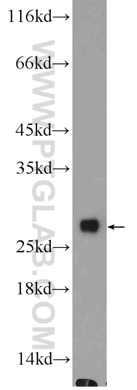 Western Blot (WB) analysis of HL-60 cells using Grancalcin Polyclonal antibody (15787-1-AP)