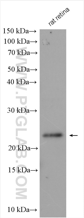 Western Blot (WB) analysis of various lysates using GCAP2 Polyclonal antibody (22298-1-AP)