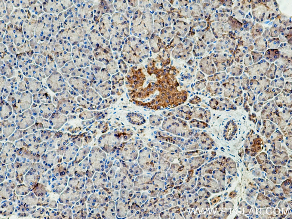 Immunohistochemistry (IHC) staining of human pancreas tissue using GCAT Polyclonal antibody (16317-1-AP)
