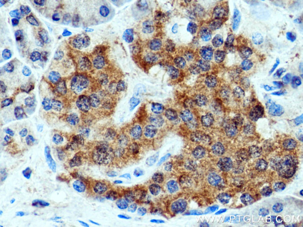 Immunohistochemistry (IHC) staining of human pancreas tissue using GCAT Polyclonal antibody (16317-1-AP)