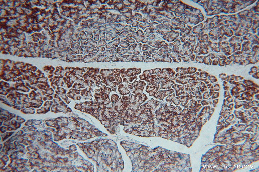 Immunohistochemistry (IHC) staining of human pancreas tissue using GCAT Polyclonal antibody (16317-1-AP)