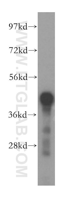 Western Blot (WB) analysis of mouse pancreas tissue using GCAT Polyclonal antibody (16317-1-AP)