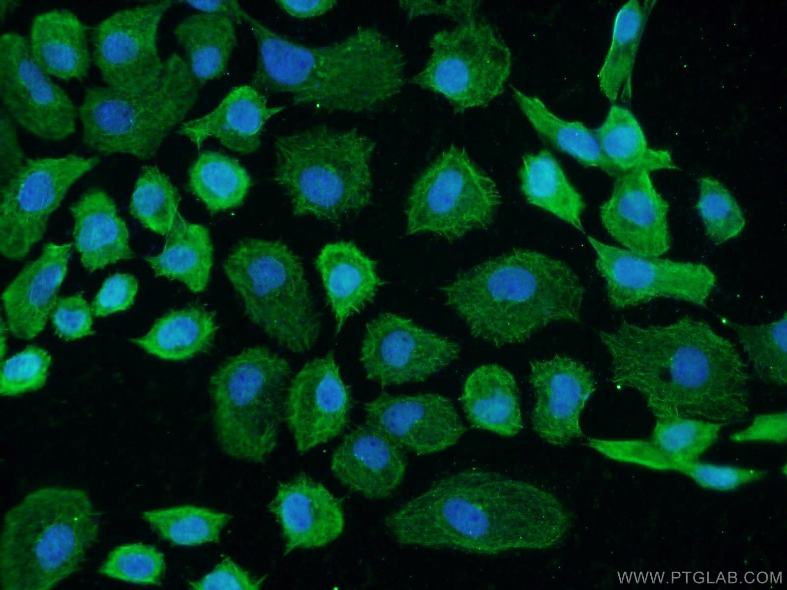Immunofluorescence (IF) / fluorescent staining of A431 cells using GCC1 Polyclonal antibody (16271-1-AP)