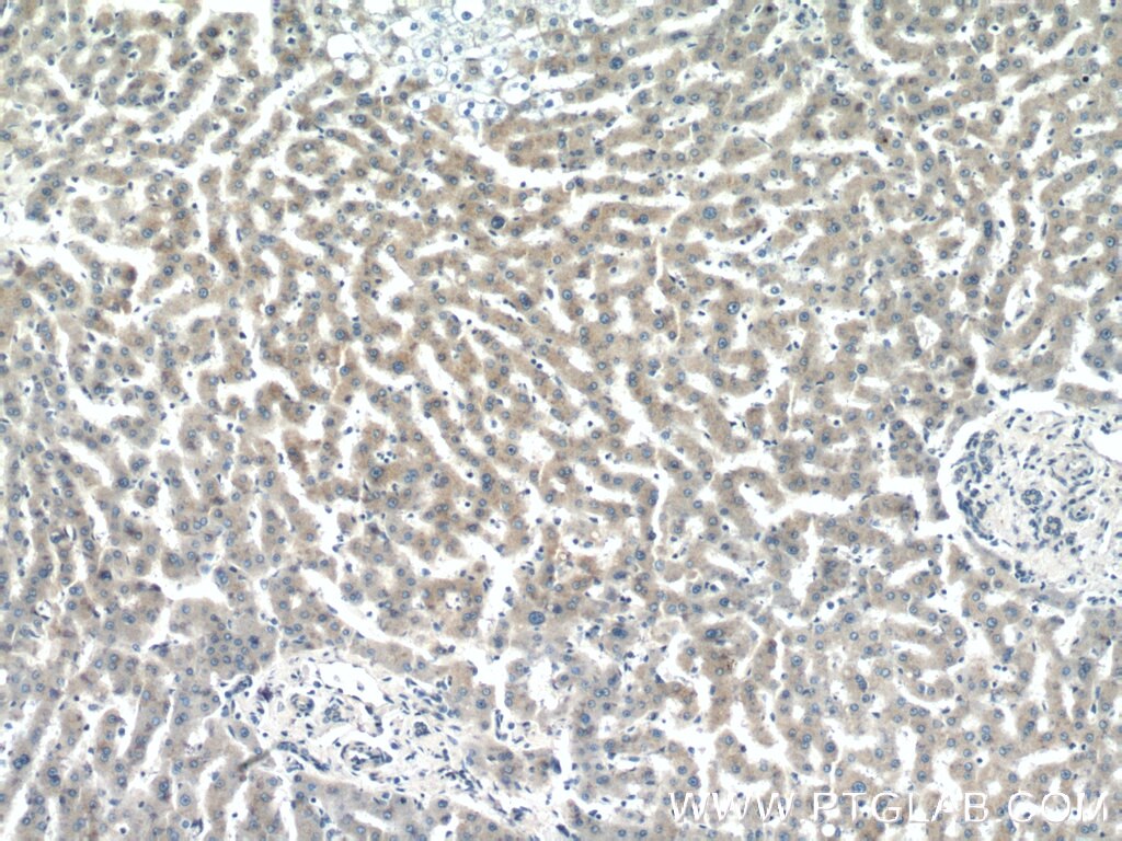 Immunohistochemistry (IHC) staining of human liver tissue using GCC1 Polyclonal antibody (16271-1-AP)