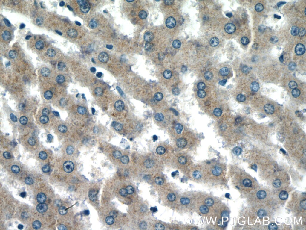 Immunohistochemistry (IHC) staining of human liver tissue using GCC1 Polyclonal antibody (16271-1-AP)