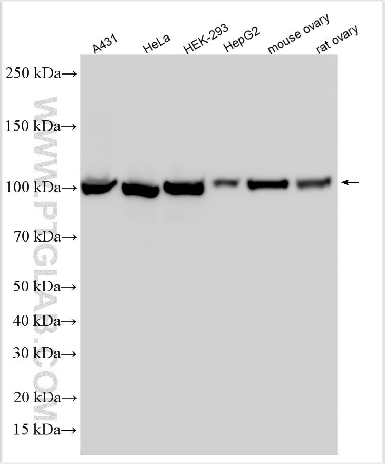 WB analysis using 16271-1-AP Western Blot (WB) analysis of various lysates using GCC1 Polyclonal antibody (16271-1-AP)