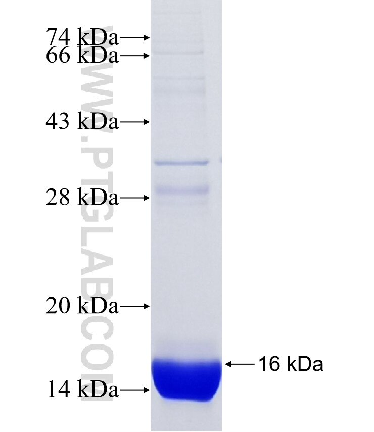 GCDFP-15, PIP fusion protein Ag31616 SDS-PAGE