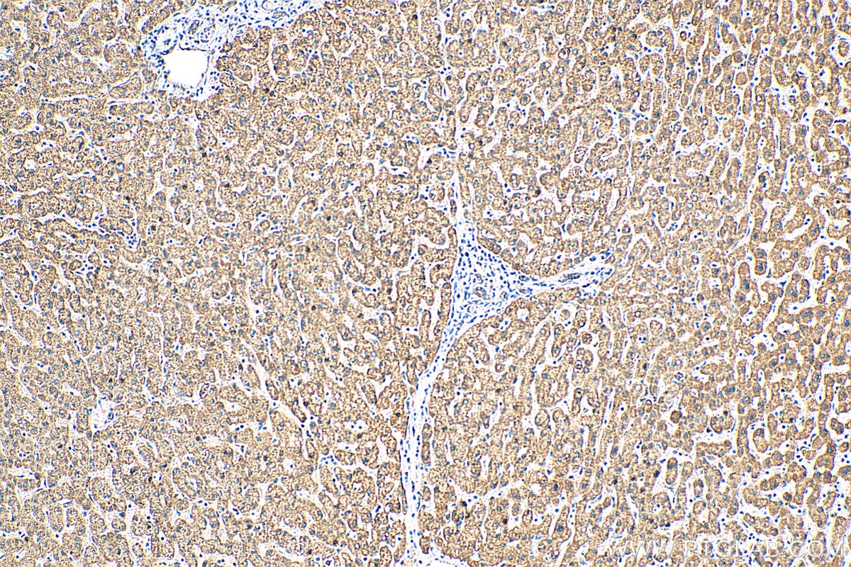 Immunohistochemistry (IHC) staining of human liver tissue using GCDH Polyclonal antibody (14930-1-AP)