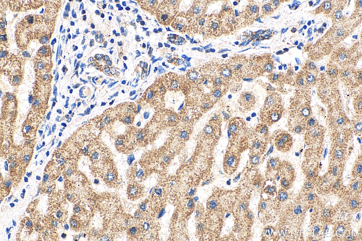 Immunohistochemistry (IHC) staining of human liver tissue using GCDH Polyclonal antibody (14930-1-AP)