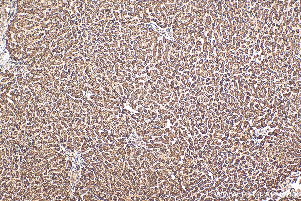 Immunohistochemistry (IHC) staining of human liver tissue using GCDH Polyclonal antibody (14930-1-AP)