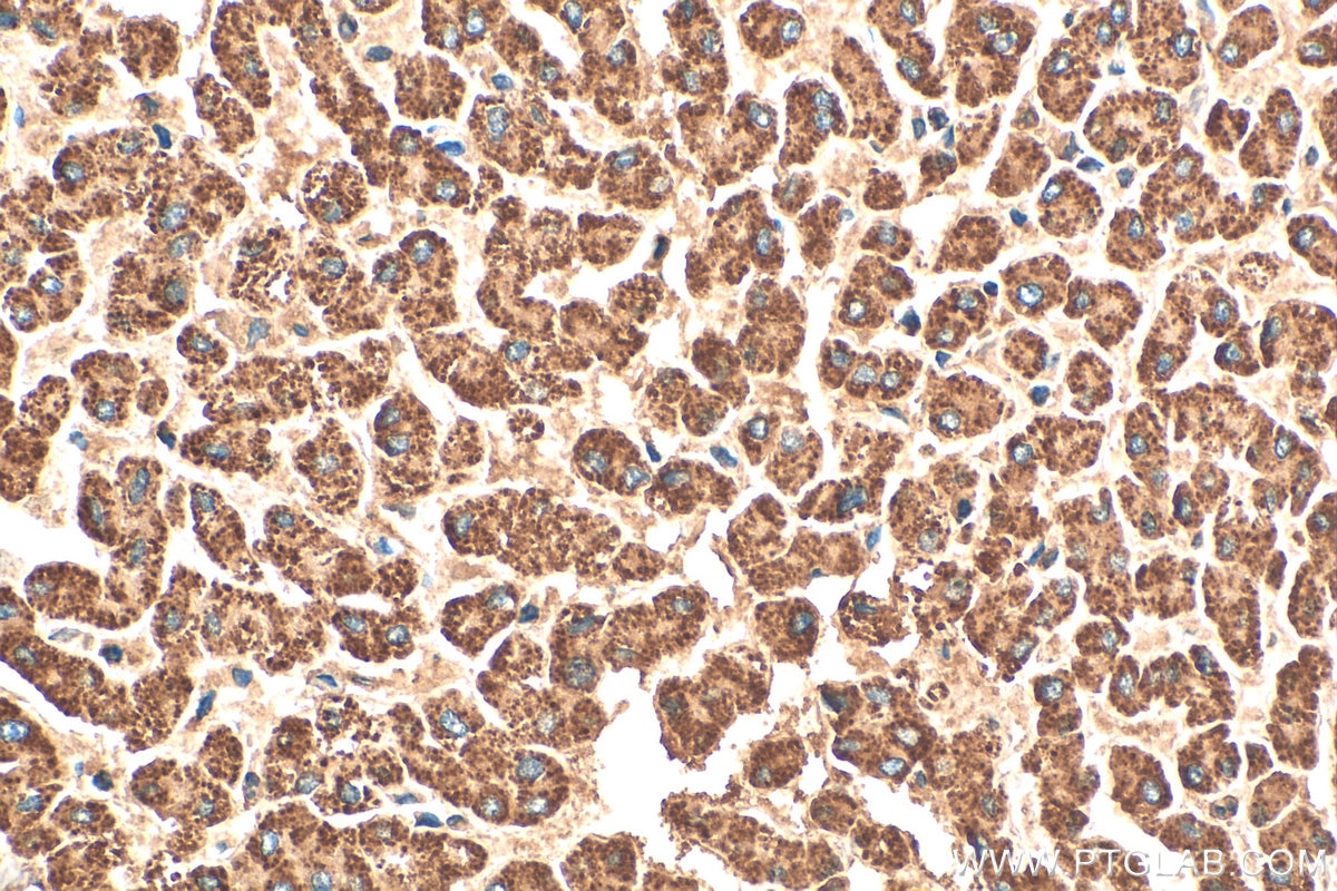 Immunohistochemistry (IHC) staining of human liver tissue using GCDH Polyclonal antibody (14930-1-AP)