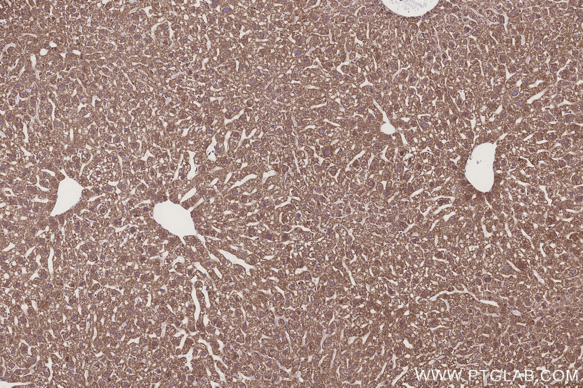 Immunohistochemistry (IHC) staining of mouse liver tissue using GCDH Polyclonal antibody (14930-1-AP)