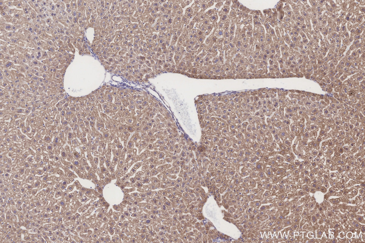 IHC staining of mouse liver using 14930-1-AP Immunohistochemistry (IHC) staining of mouse liver tissue using GCDH Polyclonal antibody (14930-1-AP)