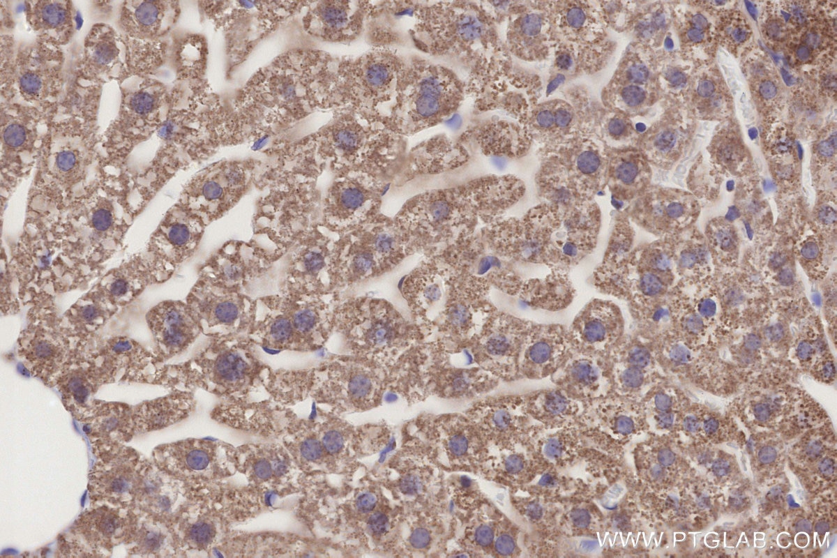 IHC staining of mouse liver using 14930-1-AP Immunohistochemistry (IHC) staining of mouse liver tissue using GCDH Polyclonal antibody (14930-1-AP)