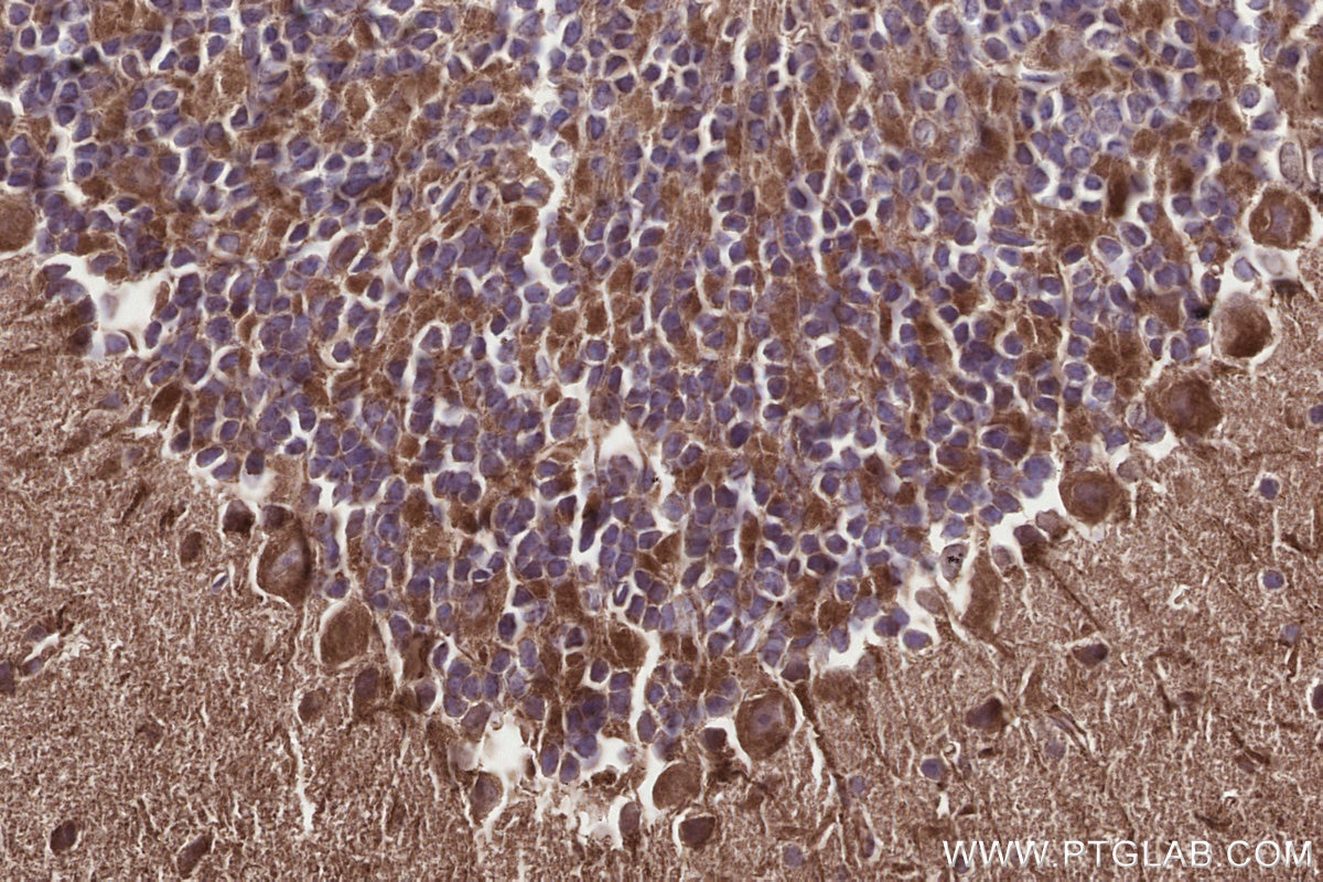 Immunohistochemistry (IHC) staining of mouse cerebellum tissue using GCDH Polyclonal antibody (14930-1-AP)
