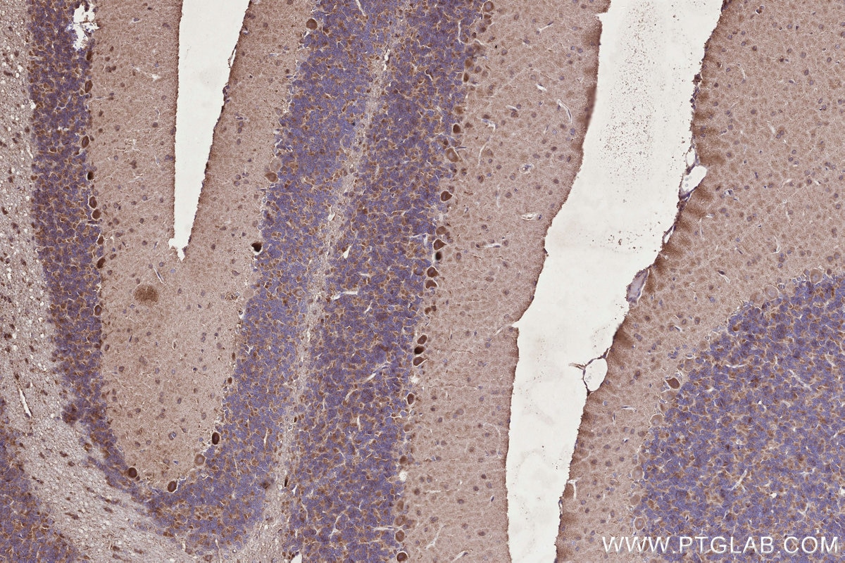 IHC staining of rat cerebellum using 14930-1-AP Immunohistochemistry (IHC) staining of rat cerebellum tissue using GCDH Polyclonal antibody (14930-1-AP)