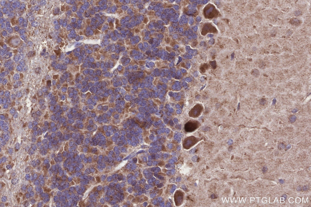 IHC staining of rat cerebellum using 14930-1-AP Immunohistochemistry (IHC) staining of rat cerebellum tissue using GCDH Polyclonal antibody (14930-1-AP)