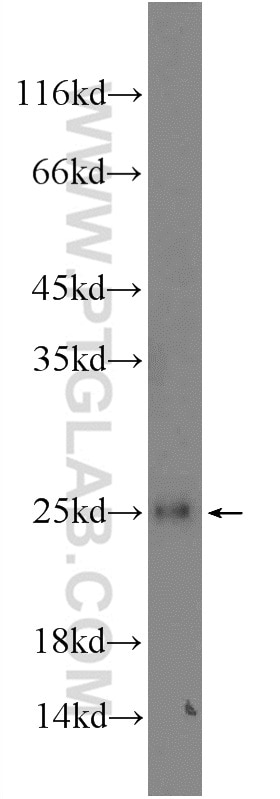 Western Blot (WB) analysis of Raji cells using GCET2 Polyclonal antibody (13447-1-AP)