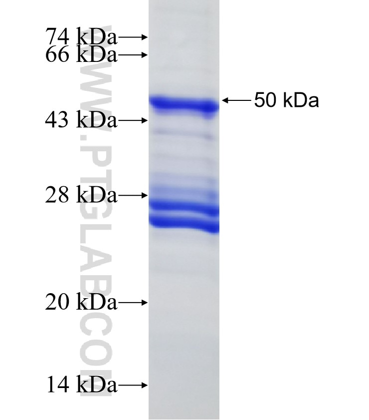 GCET2 fusion protein Ag4280 SDS-PAGE