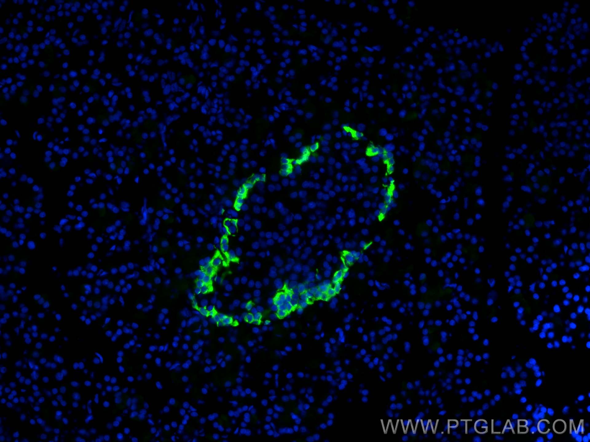 IF Staining of rat pancreas using 15954-1-AP