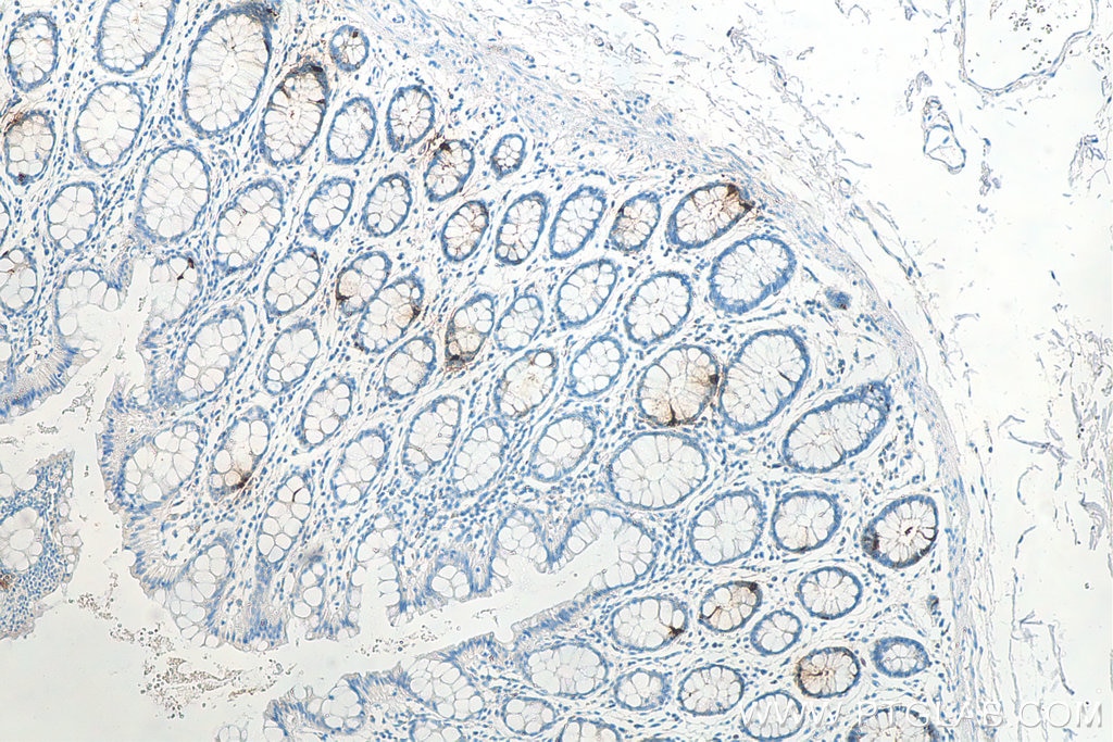 Immunohistochemistry (IHC) staining of human colon tissue using Glucagon Polyclonal antibody (15954-1-AP)