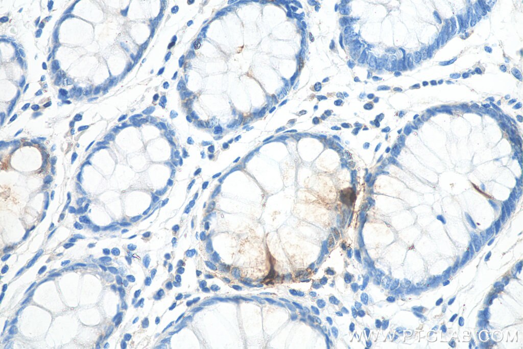 IHC staining of human colon using 15954-1-AP