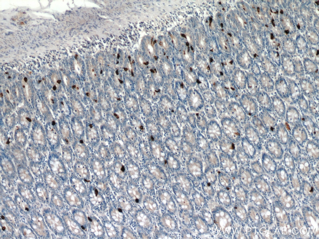 IHC staining of human small intestine using 15954-1-AP