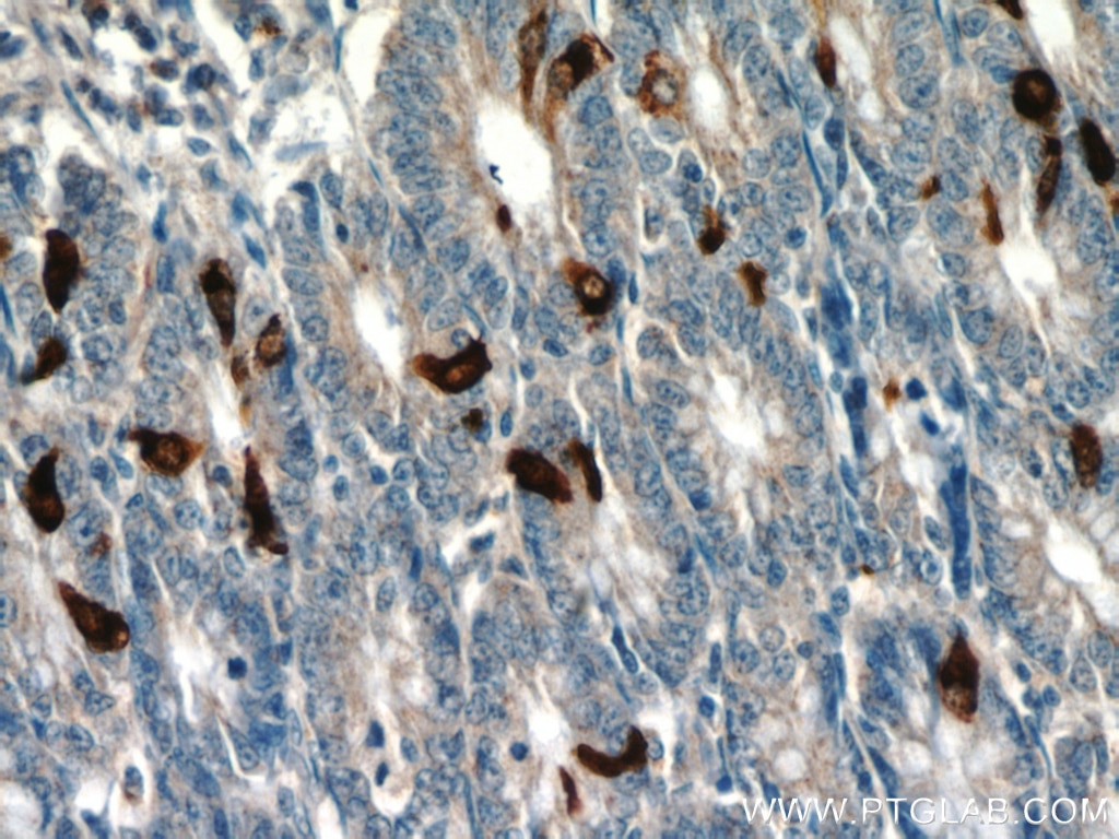 Immunohistochemistry (IHC) staining of human small intestine tissue using Glucagon Polyclonal antibody (15954-1-AP)