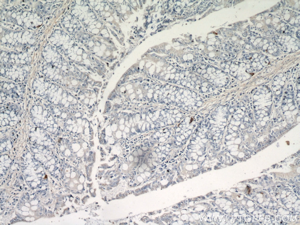 Immunohistochemistry (IHC) staining of mouse small intestine tissue using Glucagon Polyclonal antibody (15954-1-AP)