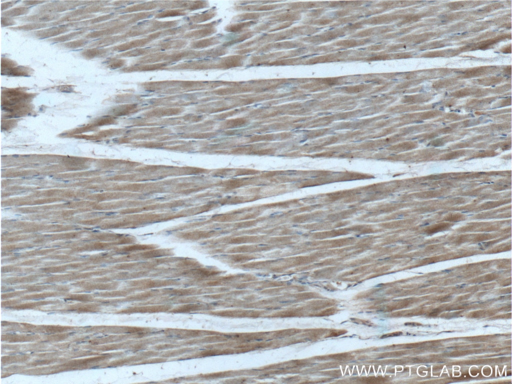 Immunohistochemistry (IHC) staining of human skeletal muscle tissue using GCGR Polyclonal antibody (26784-1-AP)
