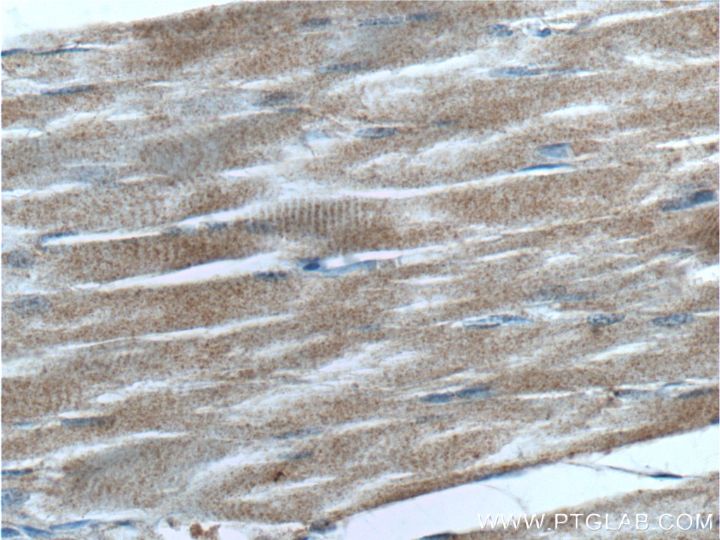 Immunohistochemistry (IHC) staining of human skeletal muscle tissue using GCGR Polyclonal antibody (26784-1-AP)