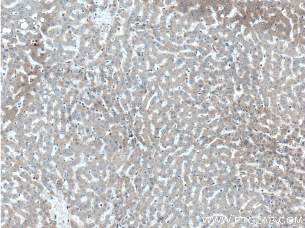 Immunohistochemistry (IHC) staining of human liver tissue using GCGR Polyclonal antibody (26784-1-AP)