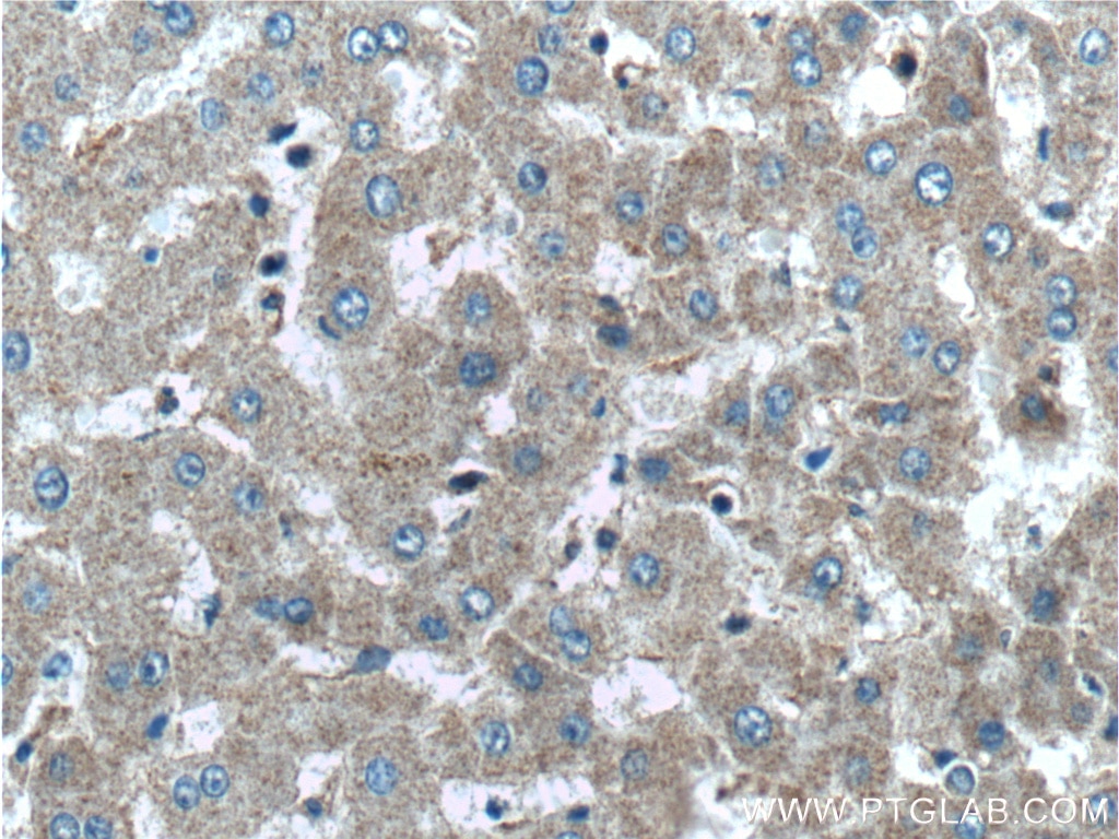 Immunohistochemistry (IHC) staining of human liver tissue using GCGR Polyclonal antibody (26784-1-AP)