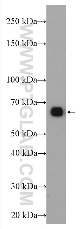 Western Blot (WB) analysis of mouse liver tissue using GCGR Polyclonal antibody (26784-1-AP)