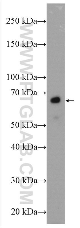 Western Blot (WB) analysis of mouse heart tissue using GCGR Polyclonal antibody (26784-1-AP)