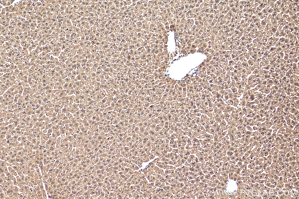 Immunohistochemistry (IHC) staining of mouse liver tissue using GCH1 Polyclonal antibody (28501-1-AP)