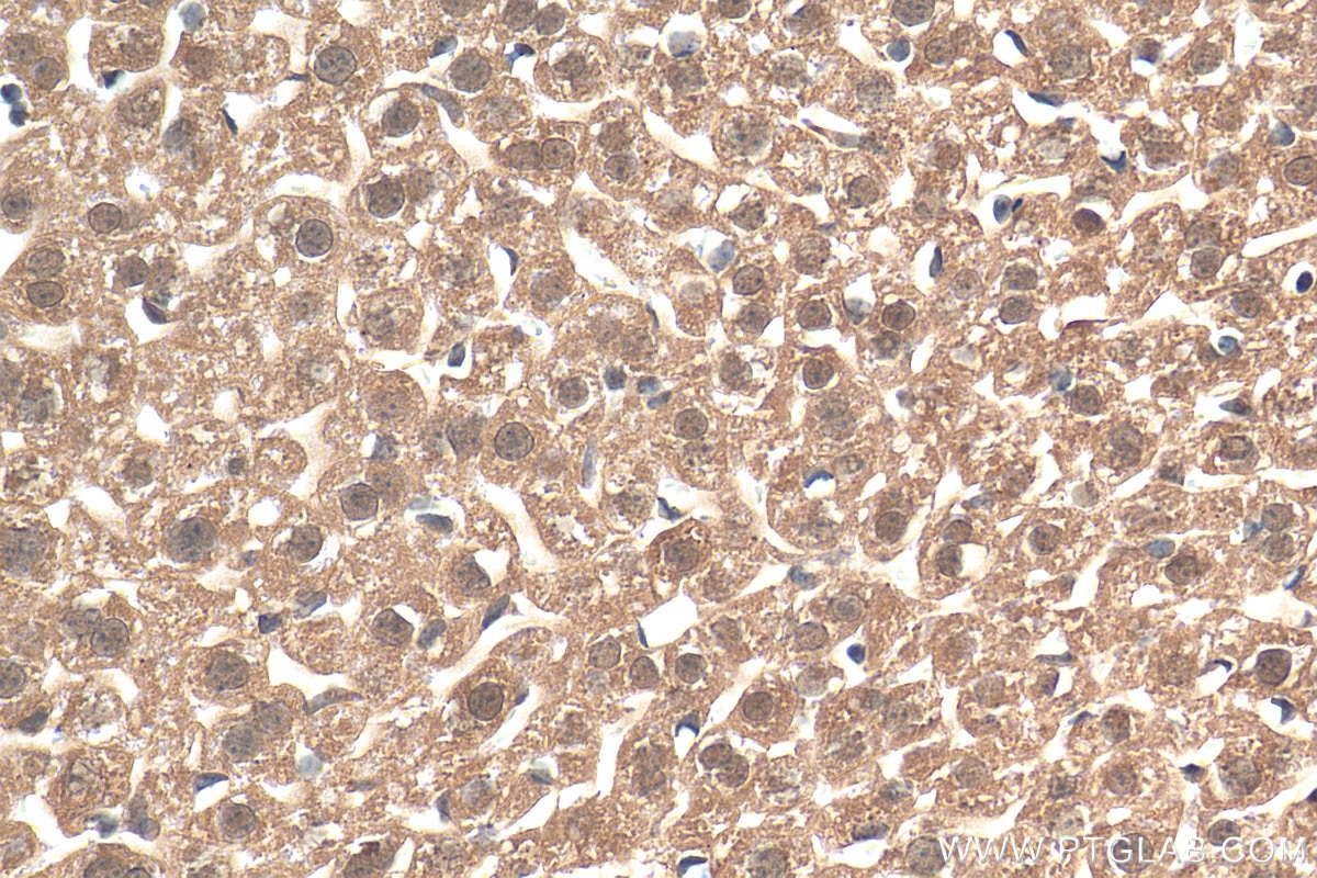 Immunohistochemistry (IHC) staining of mouse liver tissue using GCH1 Polyclonal antibody (28501-1-AP)