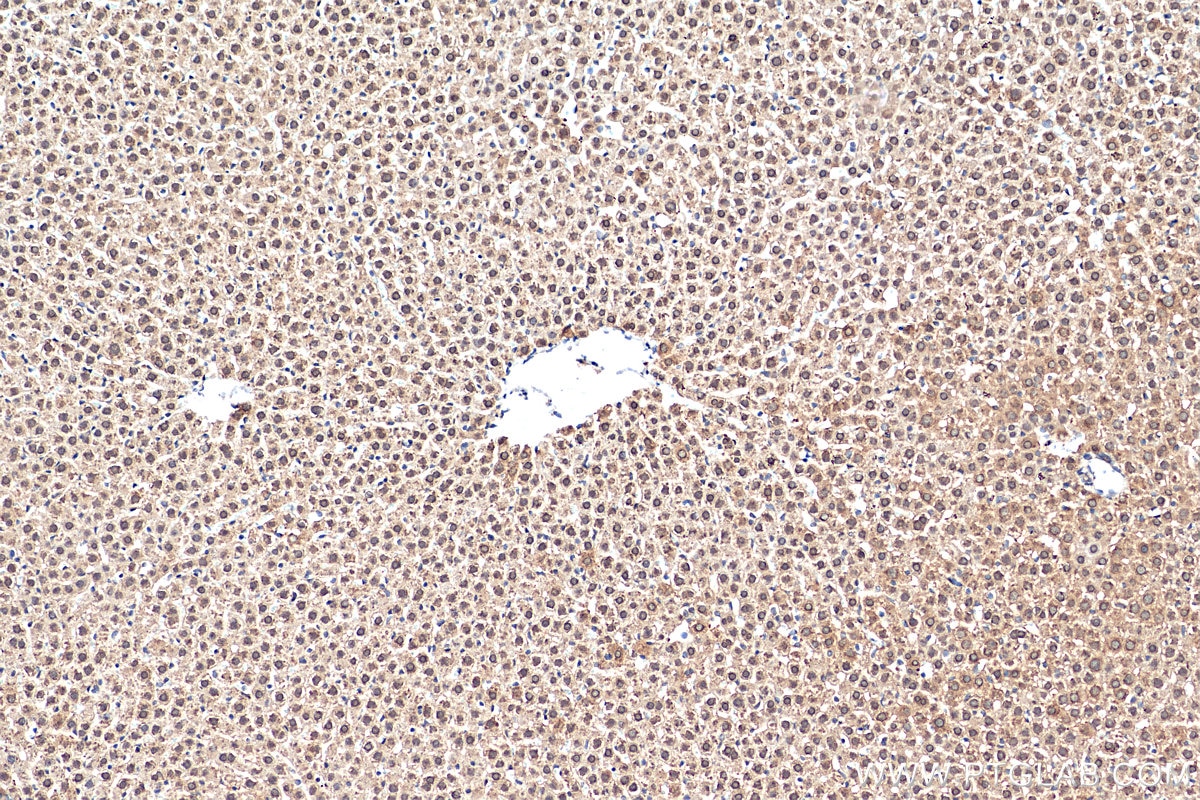 Immunohistochemistry (IHC) staining of rat liver tissue using GCH1 Polyclonal antibody (28501-1-AP)