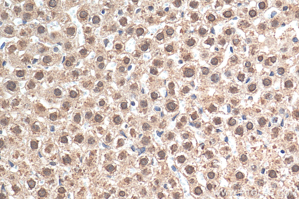 Immunohistochemistry (IHC) staining of rat liver tissue using GCH1 Polyclonal antibody (28501-1-AP)