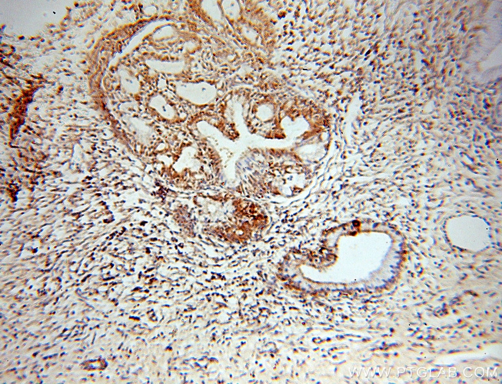 Immunohistochemistry (IHC) staining of human cervix tissue using GCHFR Polyclonal antibody (18809-1-AP)