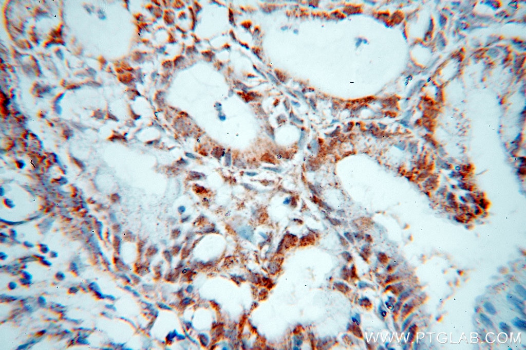 Immunohistochemistry (IHC) staining of human cervix tissue using GCHFR Polyclonal antibody (18809-1-AP)