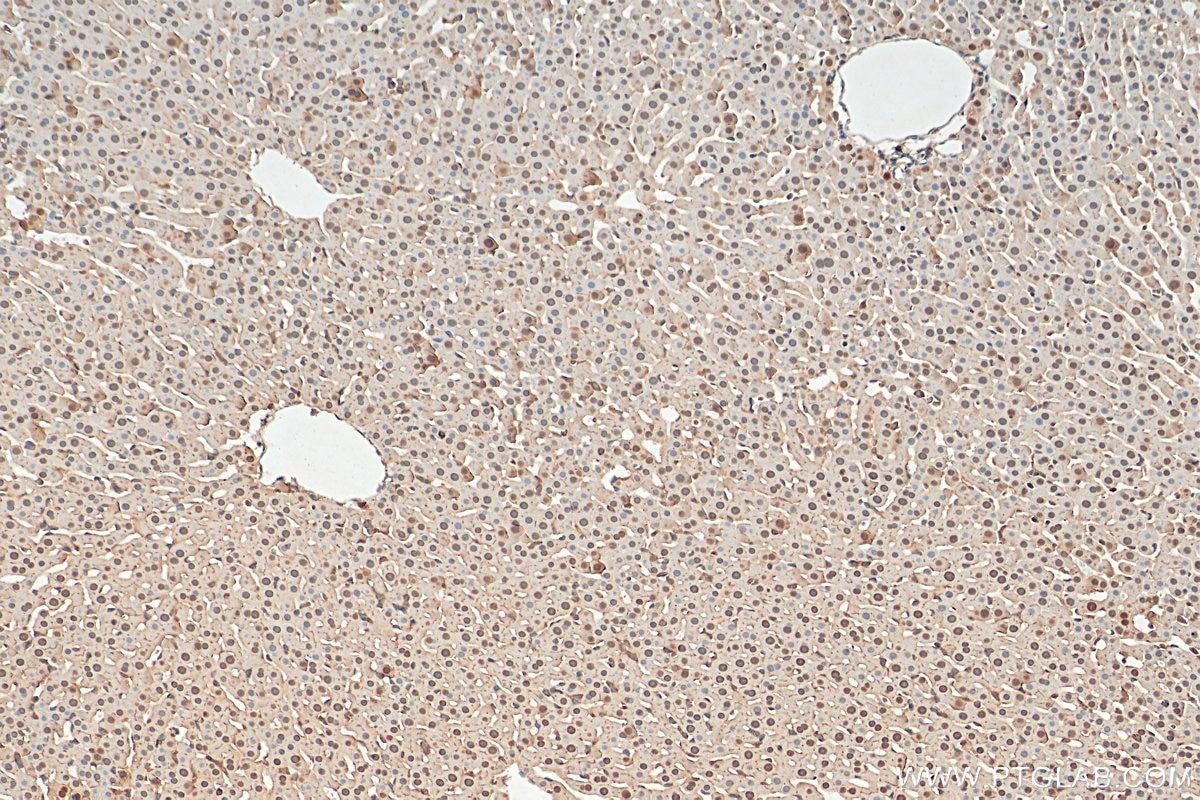 Immunohistochemistry (IHC) staining of rat liver tissue using GCK Polyclonal antibody (15629-1-AP)