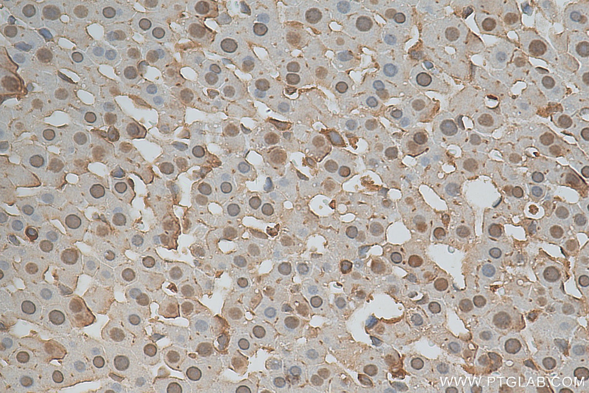 Immunohistochemistry (IHC) staining of rat liver tissue using GCK Polyclonal antibody (15629-1-AP)